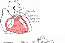 Chẩn đoán trước sinh phát hiện bệnh thông liên thất