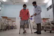 TPHCM: Dùng mảnh ghép 3D thay đoạn xương khuyết dài 11cm