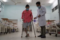 TPHCM: Dùng mảnh ghép 3D thay đoạn xương khuyết dài 11cm