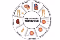 Biến chứng cấp và mạn tính trong đái tháo đường