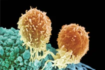 “Huấn luyện” tế bào miễn dịch chống ung thư