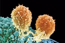 “Huấn luyện” tế bào miễn dịch chống ung thư