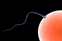  Mẫu tinh trùng có thể giúp dự đoán nguy cơ tự kỷ ở trẻ em