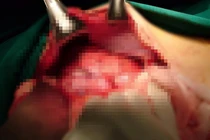 Tự chẩn đoán, tự điều trị 