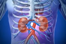 Bệnh suy thận độ 3 và cách kiểm soát bệnh từ thảo dược