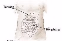 Ruột non khó tiếp cận nhất trong hệ thống tiêu hóa 