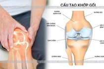  Đau khớp nên sợ vận động