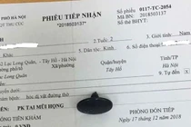 Chủ quan con hóc dị vật nguy hiểm