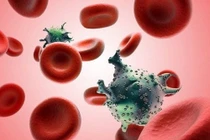 Nguyên nhân khiến ung thư tái phát