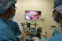  Những trường hợp không được mổ ruột thừa nội soi 