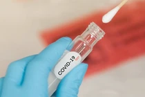 Tây Ban Nha ghi nhận số ca tái nhiễm Covid-19 cao không tưởng 