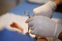 Cách chăm sóc sau cắt bao quy đầu