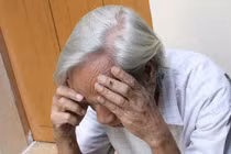 Đông y điều trị bệnh đau nửa đầu