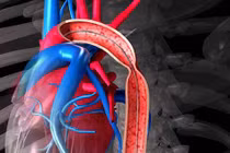 Đặt stent có cần kiêng?