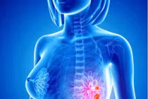 “Án tử” bệnh ung thư: Suy nghĩ tích cực, tăng sức đề kháng