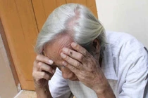 Đông y điều trị bệnh đau nửa đầu