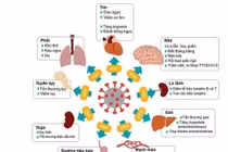 infographic: Tất cả những điều về chứng COVID-19 kéo dài