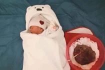 Sinh con thuận tự nhiên gây nhiều biến chứng nguy hiểm