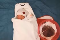 Sinh con thuận tự nhiên gây nhiều biến chứng nguy hiểm