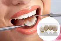 Suýt chết vì nhổ răng trong lúc có kinh