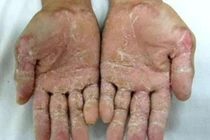 Cẩn thận khi dùng thuốc Đông y có nguồn gốc từ đá, khoáng chất 