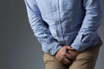  Phì đại lành tính tuyến tiền liệt ở nam giới sau tuổi 50