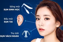 Phẫu thuật nâng mũi nên chọn chất liệu gì?