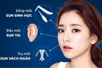 Phẫu thuật nâng mũi nên chọn chất liệu gì?
