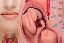 Tưởng trầm cảm sau sinh nào ngờ viêm tuyến giáp.