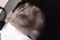 Nạn nhân được đưa đi cấp cứu trong tình trạng chấn thương nặng, mặt mũi biến dạng.