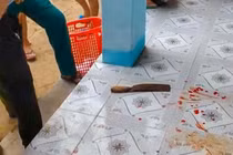 Sẽ buộc thôi việc cô giáo dùng dao tấn công đồng nghiệp