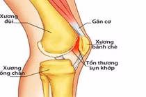  Tháo khớp và thay khớp