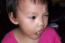 Nằm quạt và điều hòa sai cách trẻ có thể méo miệng