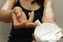 Dưỡng trắng da siêu tốc bào mòn da