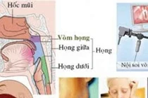 Sử dụng công nghệ NBI trong khám bệnh và tầm soát ung thư sớm