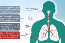 Ô nhiễm môi trường tác động đến đường hô hấp.