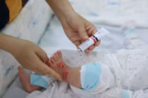 Chăm sóc đúng cách trẻ mắc viêm da cơ địa