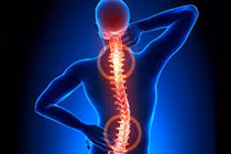 Phụ nữ trung niên làm gì để ngăn chặn tình trạng đau lưng?
