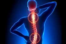 Dấu hiệu nhận biết bệnh thoát vị đĩa đệm