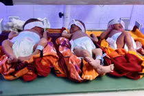 Sản phụ sinh 3 cùng trứng hiếm gặp sau 8 năm hiếm muộn