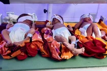 Sản phụ sinh 3 cùng trứng hiếm gặp sau 8 năm hiếm muộn