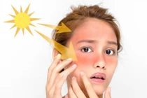 Chống nắng bằng bổ sung thực phẩm từ bên trong