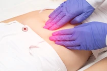 Triệu chứng của u nang buồng trứng bạn nên biết