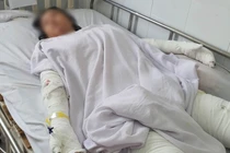 Kiên Giang: Nướng mực bằng cồn, cha mẹ bỏng nặng con gái tử vong