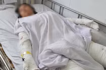 Kiên Giang: Nướng mực bằng cồn, cha mẹ bỏng nặng con gái tử vong