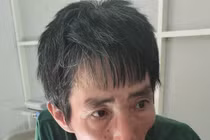 Thanh Hóa: Người đàn ông say xỉn dùng điếu cày đánh công an