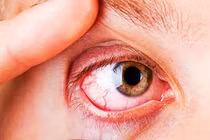 5 loại thực phẩm giúp đôi mắt khỏe mạnh