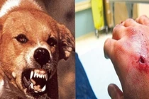 Người phụ nữ 67 tuổi tử vong sau 6 tháng bị chó nhà cắn