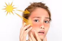 Thực phẩm giúp giảm thiểu tình trạng cháy nắng