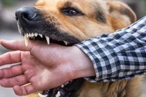 Đang chơi trước nhà, bé trai 3 tuổi bị chó dại cắn đứt nửa bên lưỡi